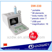 best portable ultrasound machine for people & usb ultrasound probe price (DW-330)